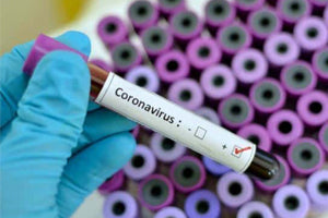 All You Need To Know About The Coronavirus Outbreak